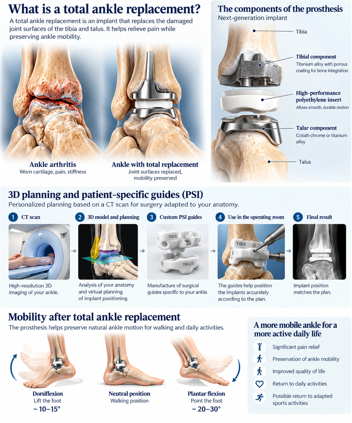 Educational infographic about total ankle replacement, its components and PSI planning