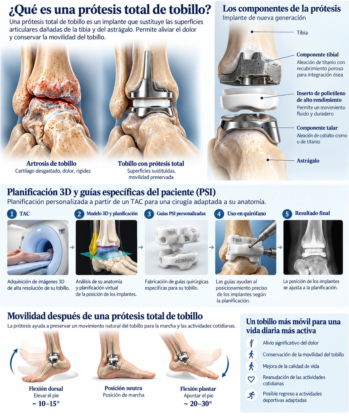 Infografía explicativa sobre la prótesis total de tobillo, sus componentes y la planificación PSI